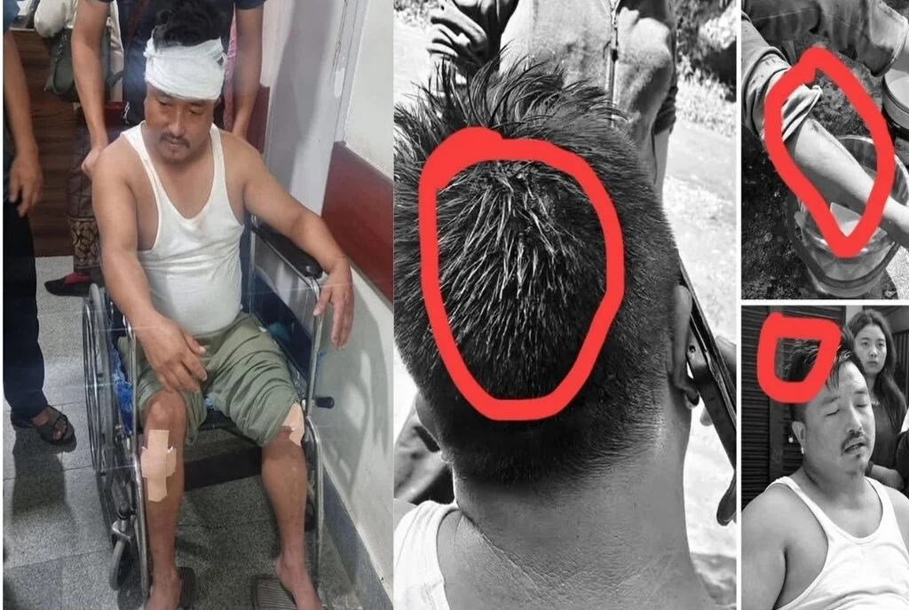 Sikkim drivers welfare Council President Ashish Rai Beaten